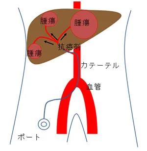 治療