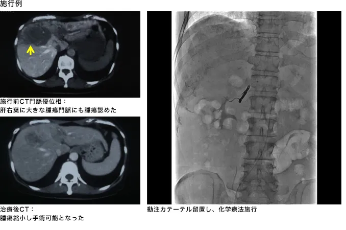 治療