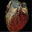 心臓・血管