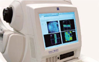 網膜断層解析装置 OCT