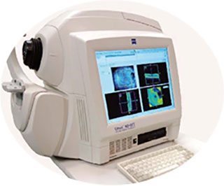 網膜断層解析装置 OCT