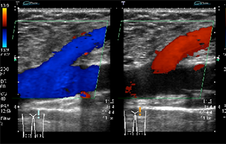 エコー検査の画像